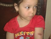 اتهام مدرسة بالتعدى على طفلة بـ"خرطوم" وإصابتها بكدمات فى جسدها بالدقهلية