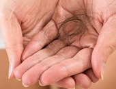علاج تساقط الشعر بنظام غذائى صحى.. سيبك من الكيماويات