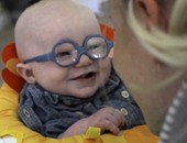 بالصور.. طفل 4 شهور يرى أمه لأول مرة بابتسامة خاطفة بسبب مرض نادر