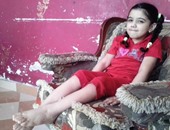 "سلمى" طفلة سيناوية تحلم بالسير على قدميها بالعلاج فى الخارج