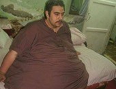 محمد يحتاج لـ150 ألف جنيه لعلاج السمنة المفرطة وآثار جلطة قلبية