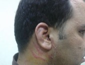 بالصور.. القبض على بلطجية اعتدوا على اطباء بمستشفى أم المصريين بالجيزة