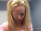 دوف كاميرون تنشر صورة بعد إصابتها بخدش فى القرنية على "تويتر"