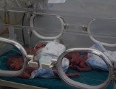 بالصور.. ولادة ستة توائم بمستشفى الجامعة بالمنصورة