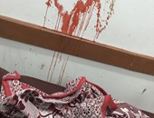 بالصور.. الدماء تلطخ حوائط غرفة الغسيل الكلوى بمستشفى إدفو العام
