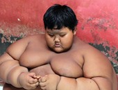 بالصور.. طفل عمره 10 سنوات يزيد وزنه عن 192 كيلو جرام