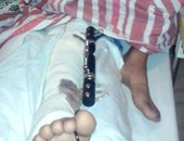صحافة المواطن: بالصور.. مغترب يتهم كفيله بالأردن بإطلاق النار عليه وإصابته