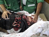 صحة غزة:استشهاد 4 وإصابة العشرات فى قصف إسرائيلى لمستشفى شهداء الأقصى