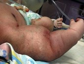 بالصور.. عامل يتهم أطباء بمستشفى إمبابة العام بخلع ذراع طفله أثناء الولادة