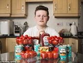 شاب إنجليزى يدمن الطماطم لإصابته باضطراب الطعام.. والسبب البازلاء
