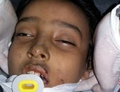 تداول صورة لطفل مجهول مصاب فى حادث سير وإيداعه مستشفى سفاجا المركزى