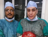 استئصال ورم يزن 13 كيلو فى عملية جراحية نادرة لمريض مسن بجامعة أسيوط