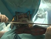 "التليجراف" تنشر فيديو لامرأة تعزف الكمان أثناء خضوعها لعملية بالمخ