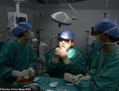 بالصور.. طبيب صينى يجرى عملية لنفسه ليخلص زوجته من إزعاج شخيره