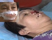 بالفيديو..سيدة صينية: زوجى أكل أنفى وبلعها لأنى لم أرد على اتصاله