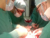 جراحة ناجحة بالميكروسكوب الجراحى لإنقاذ طفلة من الإعاقة بمستشفى المنوفية الجامعى