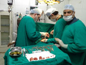 عمليات نادرة.. أشهر إنجازات الأطباء المصريين فى عمليات الأورام السرطانية