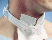 نجاح أول عملية زراعة أنبوب للتنفس لطفلة عمرها عامين