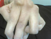 كيف تلاحظين إصابة طفلك بمرض مناعى.. 6 أعراض تعرفى عليها