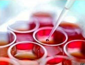 للتقليل من استخدام المضادات الحيوية.. اكتشاف اختبار دم جديد يشخص مرضك