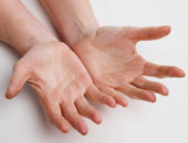 هل جلسات الليزر تفيد فى علاج تشققات الجلد؟