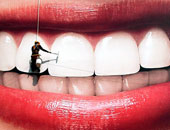 هل تعانى من مشكلة تلون الأسنان؟