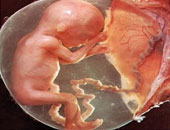 دراسة أمريكية: تعرض الجنين لمادة "الفثاليك" يؤثر على ذكاء المولود