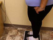 أخصائى سمنة: التحويل المصغر حل فعال لعلاج زيادة الوزن