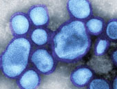 مصدر بصحة أسيوط: وفاة 10 حالات وإصابة 60 آخرين بأنفلونزا الخنازير بأسيوط