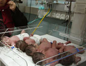 منظمة الصحة العالمية: ولادة طفل مبتسر من بين كل عشرة أطفال عالميًا 