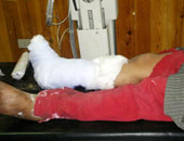 سوريا: مقتل طفلين وإصابة 10 آخرين في انفجار لغم بريف درعا