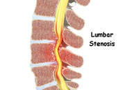علماء أستراليون يقومون بتطوير حبل شوكى آلى