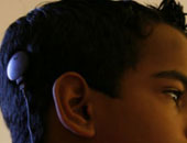 توقيع بروتوكول تعاون للقضاء على مرضى السمع من الأطفال