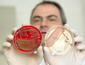 وفاة شخصين وإصابة 5 بالبكتيريا المقاومة للمضادات الحيوية فى أمريكا