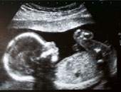 لو حامل لأول مرة.. معلومات لازم تعرفيها عن حركة الجنين 
