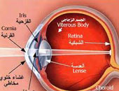 التهابات القرنية المتكررة من أمراض العيون الأكثر انتشارا فى الريف