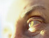 عقار جديد يعالج أمراض العين الناجمة عن الإصابة بالسكر