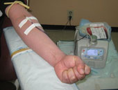 الصحة: علاج المتبرعين بالدم حال إصابتهم بفيروسىC والإيدز على نفقة الدولة