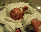 ما طريقة إسعاف التهابات أذن الأطفال؟