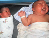 الأطفال المولودون قبل الأوان يحتاجون إلى فيتامين (د) والكالسيوم