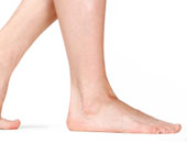 القدم المسطحة "الفلات فوت" تسبب آلام فقرات الظهر 