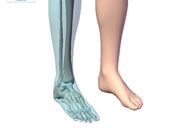 دراسة: الليزر قد يصبح الحل الأمثل لعلاج توسع الأوردة