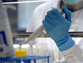 علماء: اكتشاف علاج لفيروس الإيدز من حيوان اللاما.. قريبا