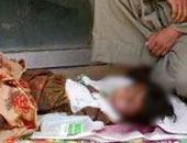 مصرع طفلة صدمتها سيارة أثناء لهوها أمام منزلها فى دمنهور
