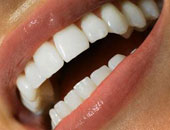 أطباء الأسنان ينصحون بوضع السن المخلوع فى حليب بارد لإعادة زرعه