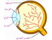 تعرف على أسباب الإصابة بالتهابات العصب البصرى