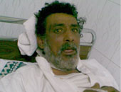 وزارة الصحة تتولى علاج إحدى حالات «احكوا» على نفقة الدولة