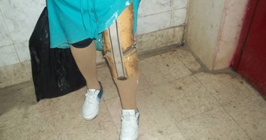 قارئ من الغربية يناشد الصحة تركيب طرف صناعى لجدته وعلاجها.. والصحة ترد