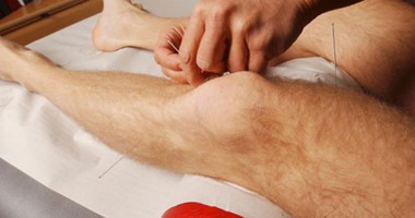 دراسة تكشف لماذا ينجح الوخز بالإبر فى العلاجات الطبية