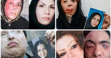 نشطاء يتداولون صورة لإيرانيات استهدفن برش "ماء النار" لعدم ارتدائهن الحجاب